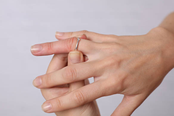 Swollen Hands? The Ring Sizing Puzzle.